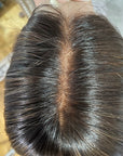 Frontals